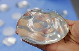 پروتز سینه می تواند موجب سرطان شود؟